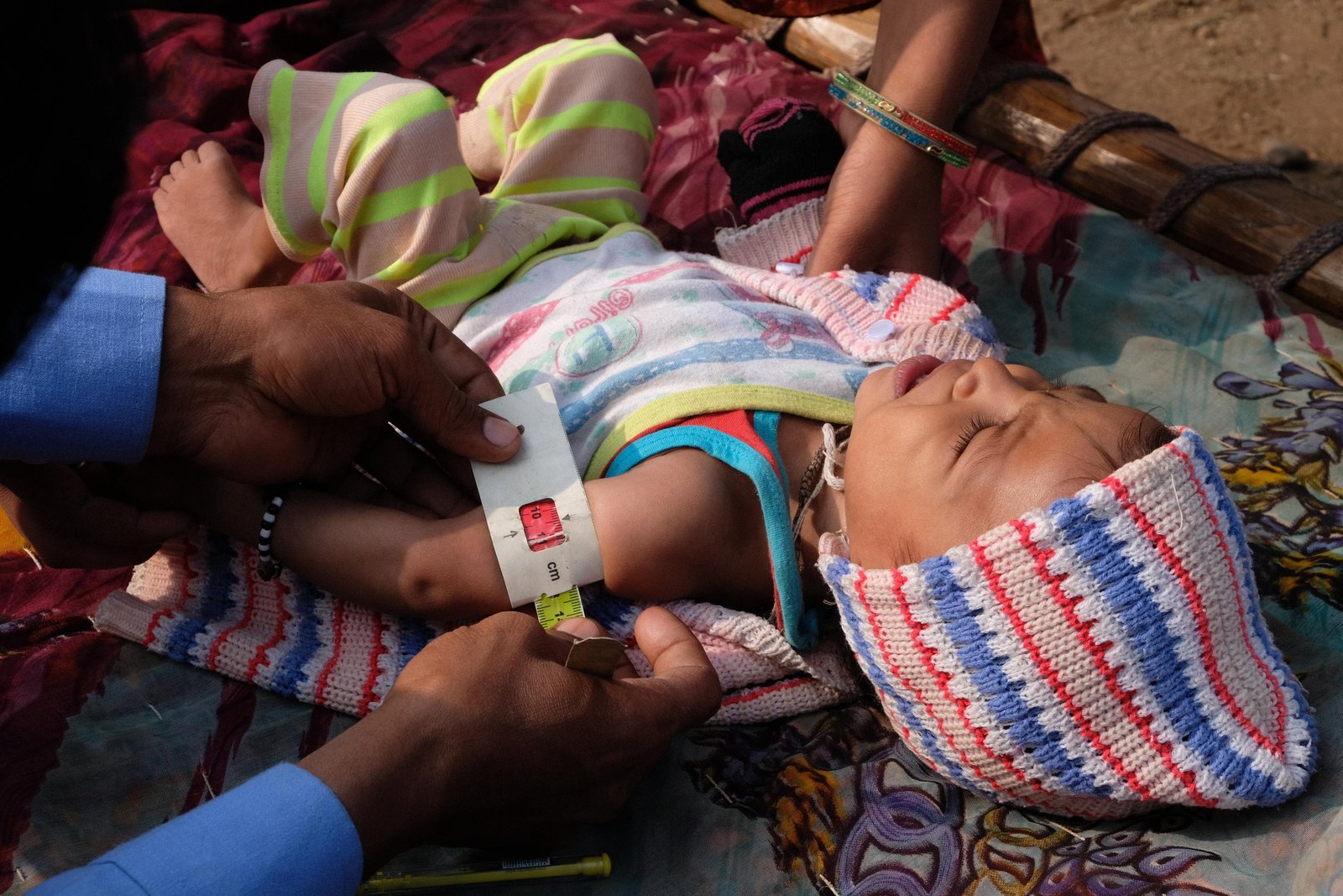malnourished children_04january2022 (2)